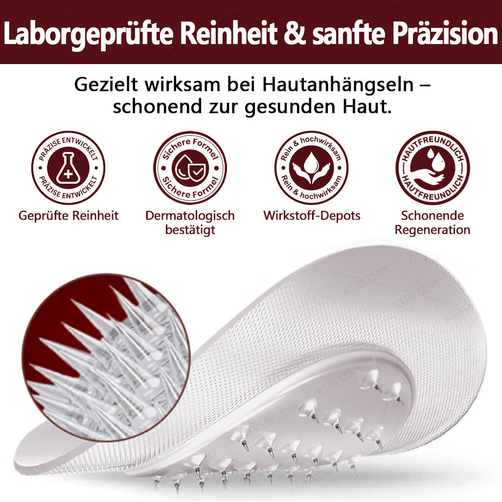 KUBOZN® OryzaDarts TAG’GONE – Schmerzfreie Entfernung an der Wurzel dank Schwarzer-Reis-Mikrotechnologie ✨  (offer)