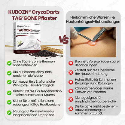 KUBOZN® OryzaDarts TAG’GONE – Schmerzfreie Entfernung an der Wurzel dank Schwarzer-Reis-Mikrotechnologie ✨  (offer)