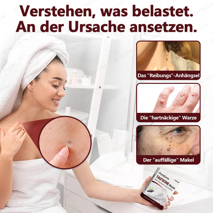 KUBOZN® OryzaDarts TAG’GONE – Schmerzfreie Entfernung an der Wurzel dank Schwarzer-Reis-Mikrotechnologie ✨  (offer)