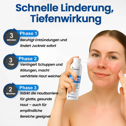✅KUBOZN® Neuro-Calm Anti-Juckreiz Akut-Spray – 3-Minuten-Ruhe bei Juckreiz (offer)